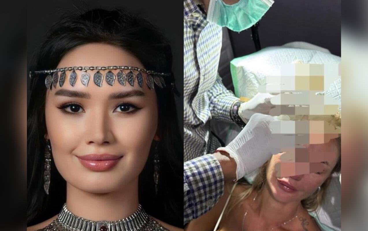 Qazaxıstanlı model rus bloqeri amansızcasına d&ouml;yd&uuml; 