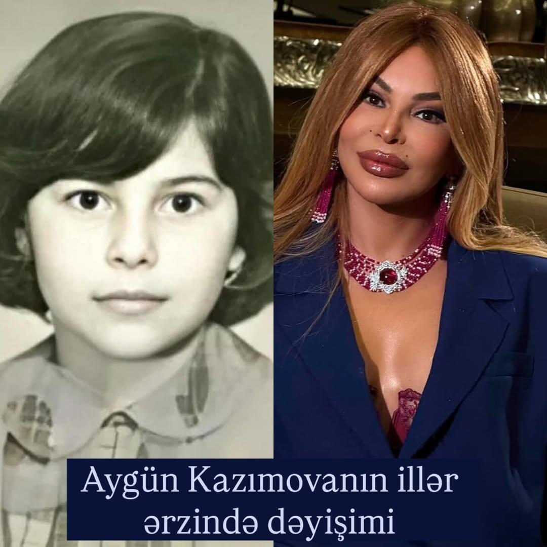 Aygün Kazımovanın illər ərzində dəyişimi 