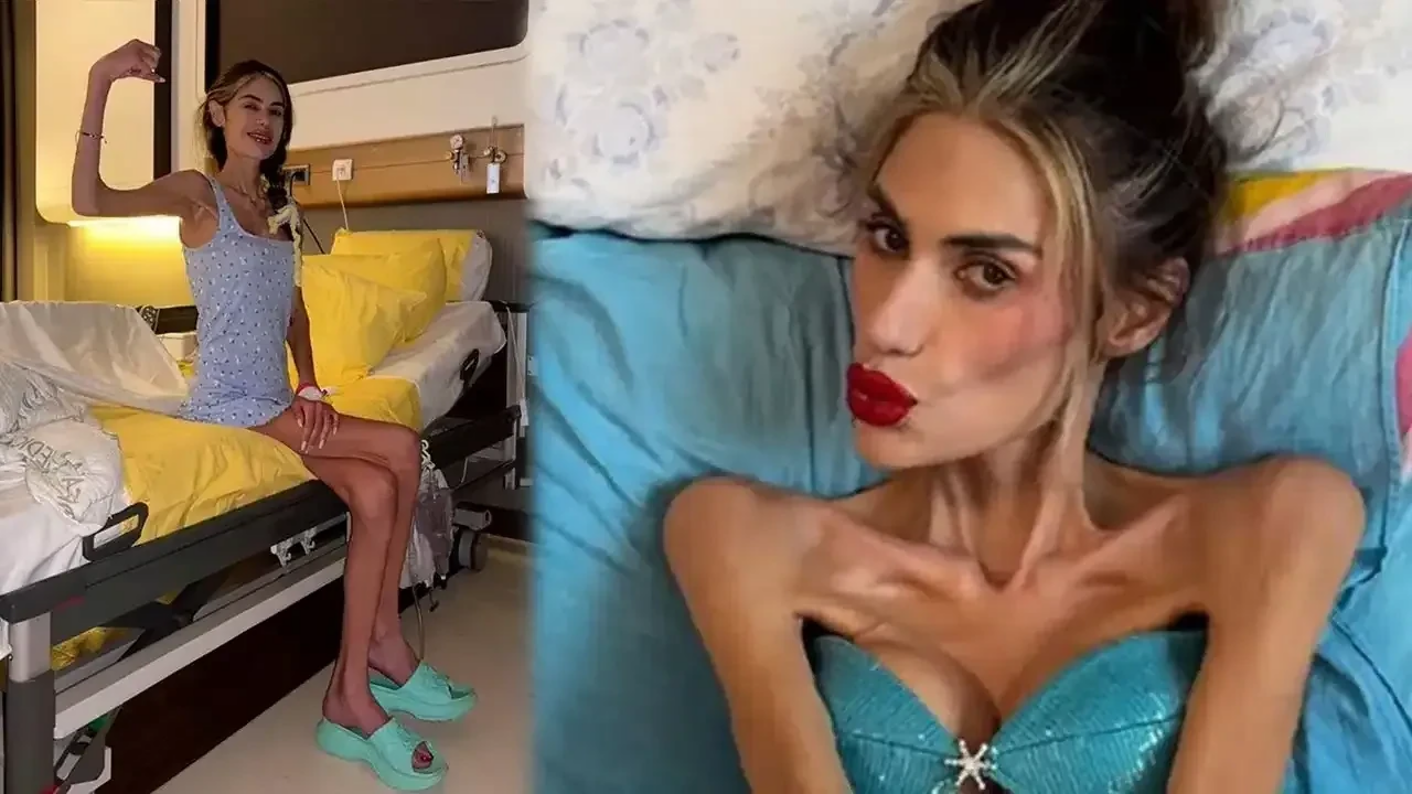 Çəkisi 23 kiloqrama düşən məşhurdan