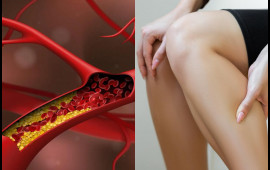 Qan laxtalanması problemi genetik imiş