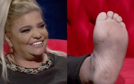 Kibariyənin ayağı sosial mediada g&uuml;ndəm oldu