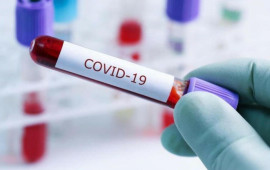 Koronavirusun bilinməyən fəsadı &uuml;zə &ccedil;ıxdı  Yoluxanların 35 faizində...