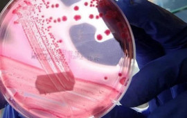 Kişilərdə ən çox rast gəlinən ikinci xərçəng növü hansıdır?