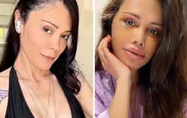 Əməliyyatla &uuml;z&uuml;n&uuml; dəyişdirdi, tanınmaz hala d&uuml;şd&uuml; 