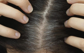 Saçlar niyə vaxtından tez ağarır?  Stresslə əlaqəsi yoxdur