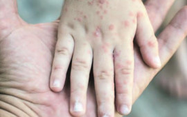 Bakıda uşaq evində azyaşlı qızılcadan &Ouml;LD&Uuml; 