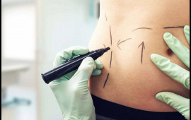 Sevgilisinin "dar gün" üçün yığdığı 140 min dollarını gizlicə estetik əməliyyatlara xərclədi