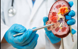 Böyrək daşlarının yaranmasına səbəb olan qidalar açıqlandı