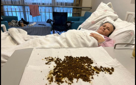 Qarın ağrısından şikayət etdi, ödündən 20 mindən çox daş çıxdı 