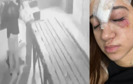 Qorxu evinə getdi  Alnına 11 tikiş qoyuldu