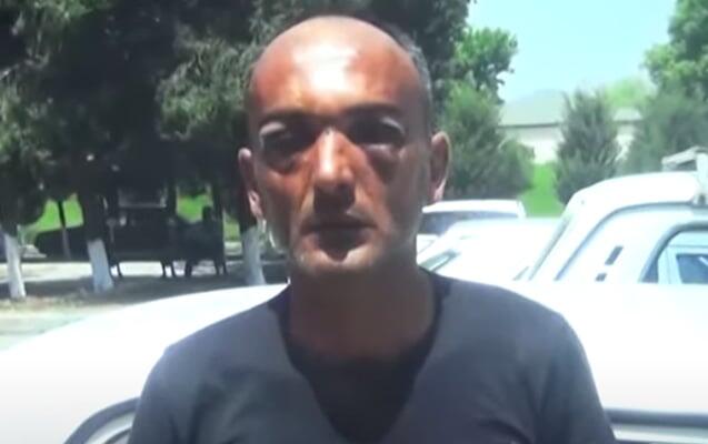 Toyda döyülmüşdü  9 gün sonra öldü 