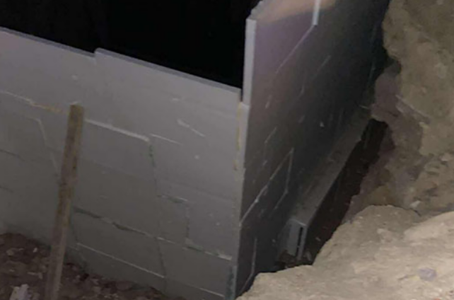 Bakıda kişi quyuya düşüb xəsarət aldı 