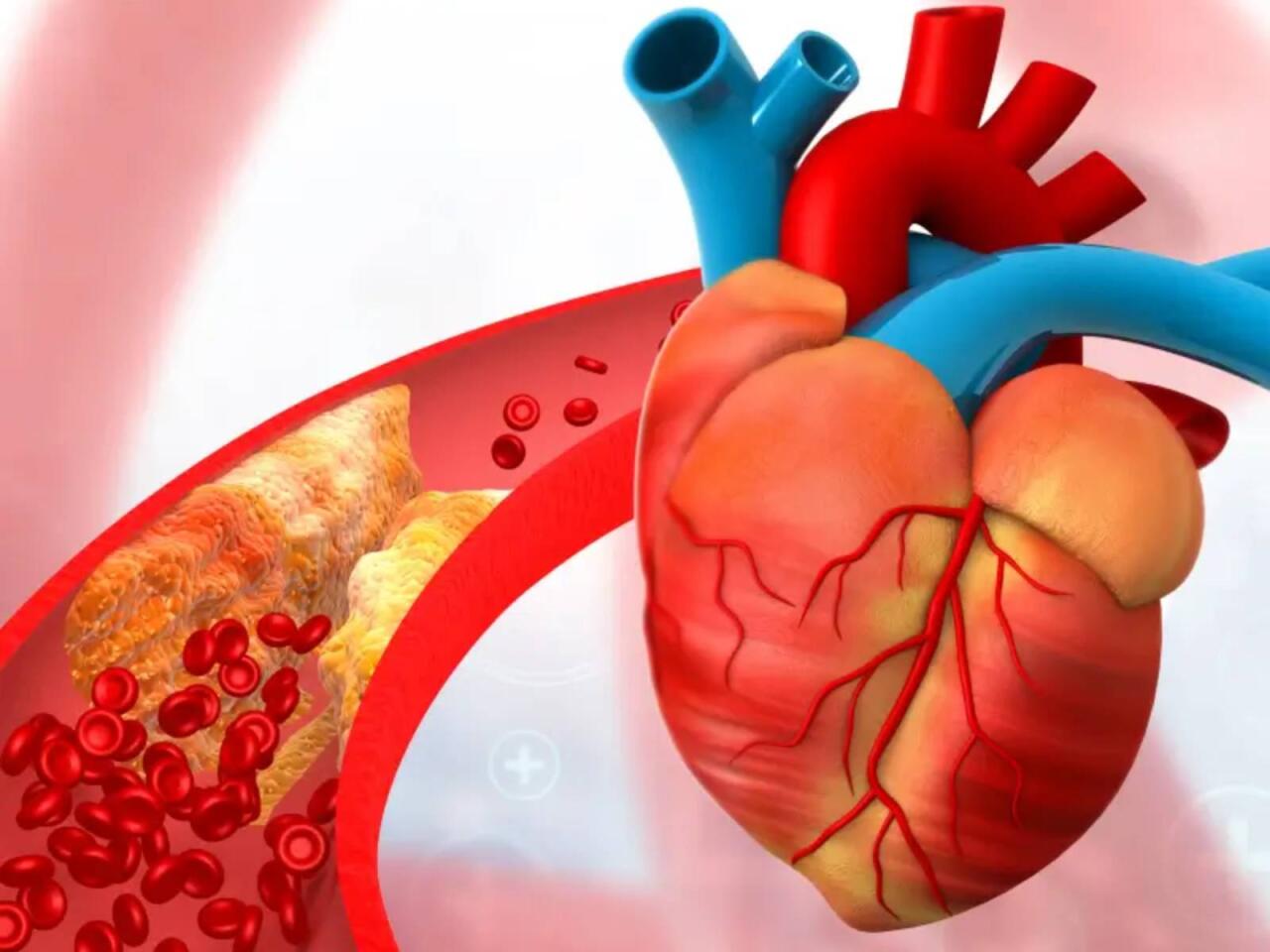 Duz, alkoloq, qəhvəni eyni vaxtda qəbul etmək olmaz  Damarlar dözməyəcək