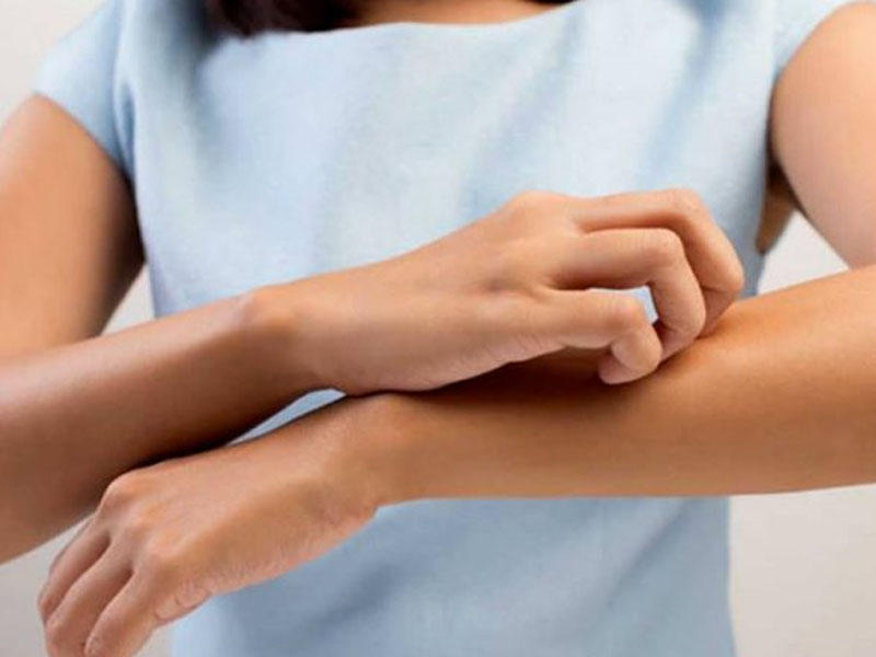 Qaşınmanın səbəbi bu imiş  Alimlər araşdırıb tapdı