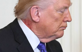 Trampın boynuna nə olub? 